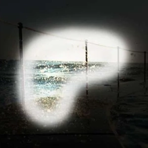 glaucoma, eye conditions treatments